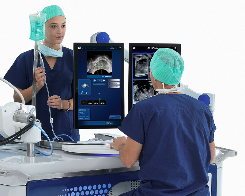 Focal One FAQs – High Intensity Focused Ultrasound for Prostate Cancer