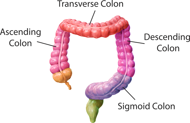 About Colorectal Cancer: Symptoms, Risk Factors, Diagnosis & Stages ...