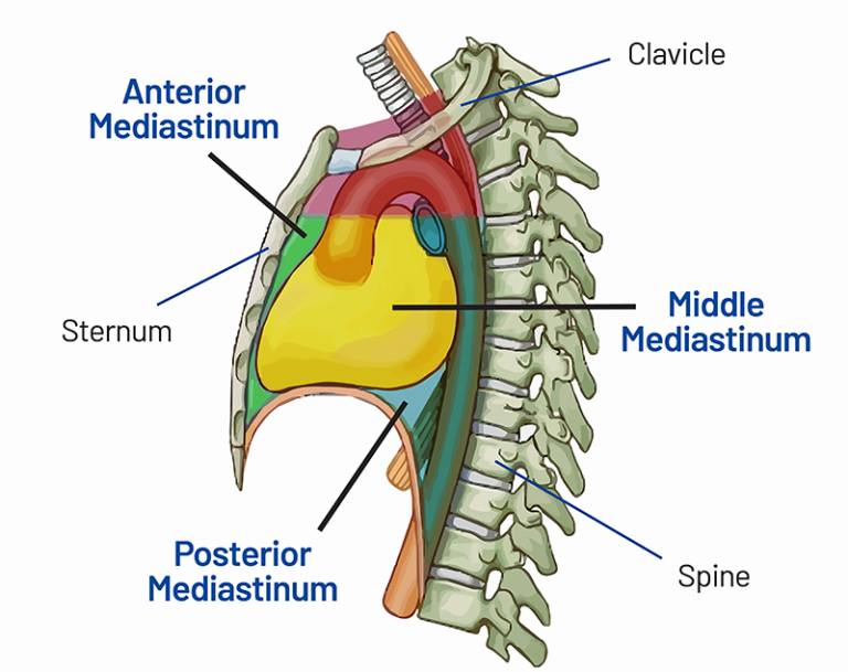 Mediastinal Tumor Mass Symptoms Diagnosis And Stages Saint Johns Cancer Institute