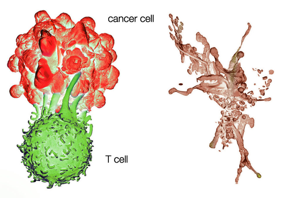 Translational Cancer Immunology - Saint John’s Cancer Institute