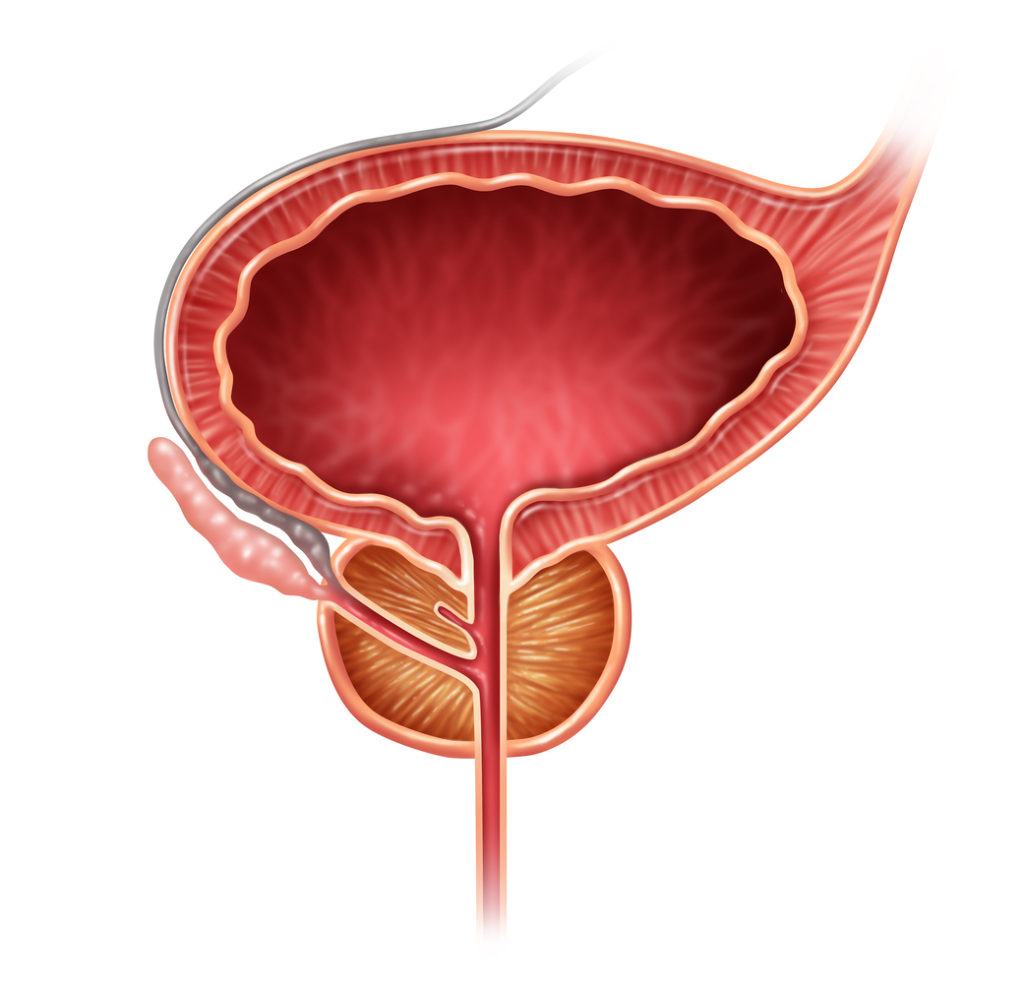 Bph Symptoms Risk Factors And Diagnosis John Wayne Cancer Institute 5471